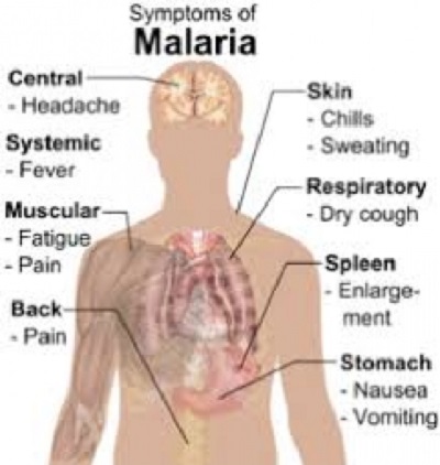 malaria+mbd