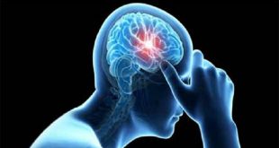 Stroke+Mass+Awareness+mbd-2